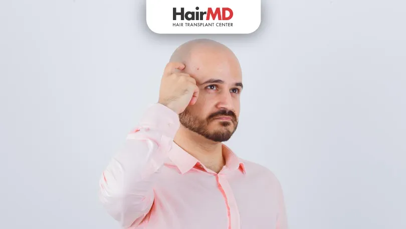 Can-a-fully-bald-person-get-a-hair-transplant