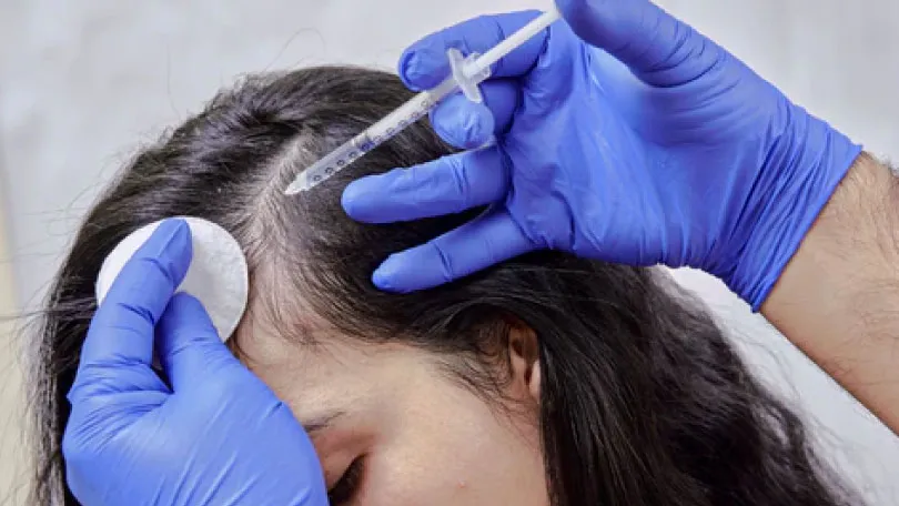 exosomes for hair Growth