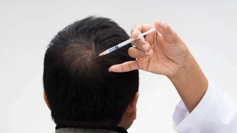 GFC therapy for Hair Growth