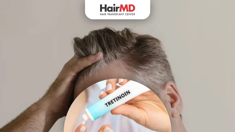 Know More About Tretinoin and Hair Connection HairMD Pune