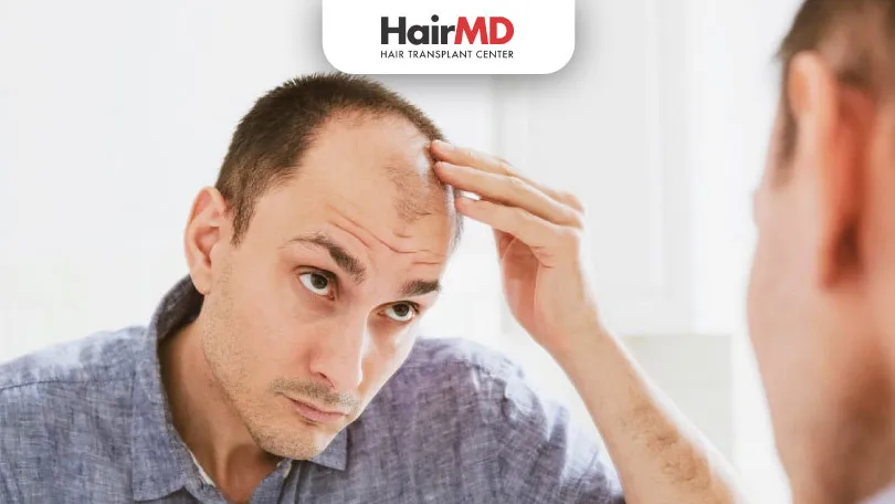Why-is-Hair-Loss-More-Common-in-Men-than-Women.